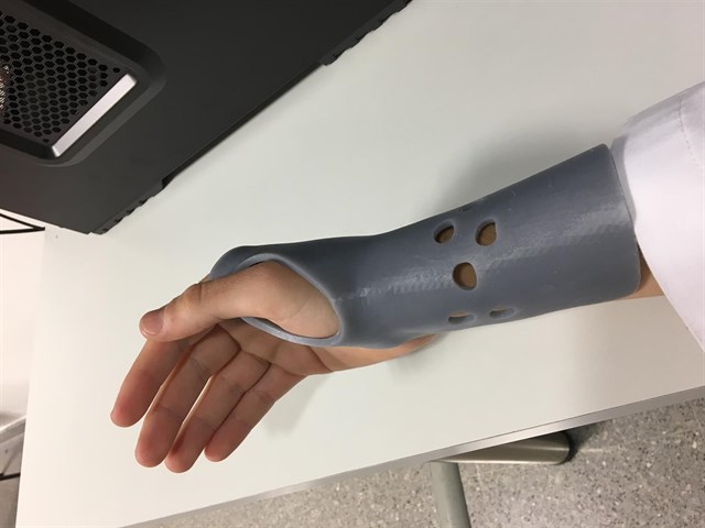 En los hospitales de Zaragoza ya se están usando las tecnologías de impresión en tres dimensiones