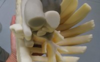 Una impresión 3D que ayudaría a una niña a sobrevivir 